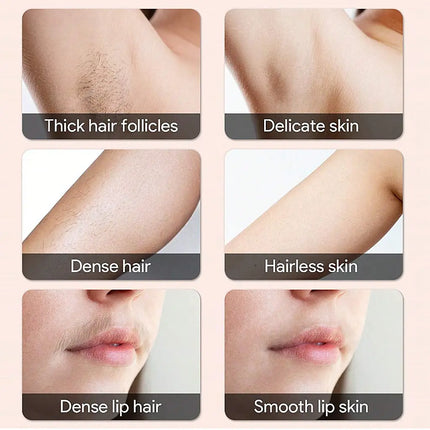 StrideNurture IPL - Fast & Effective Hair Removal