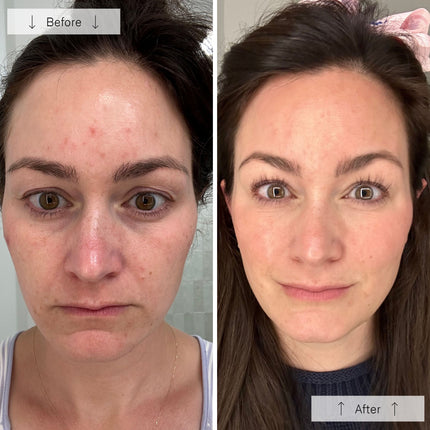 StrideNurture Contour Face