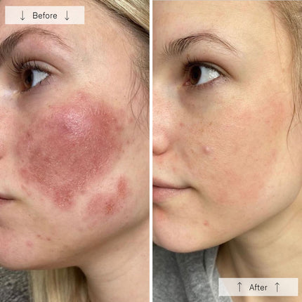 StrideNurture Contour Face