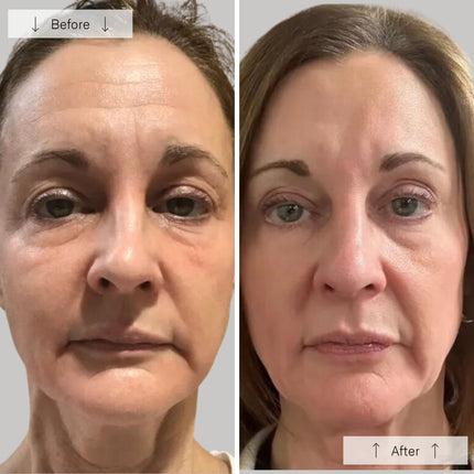 StrideNurture Contour Face
