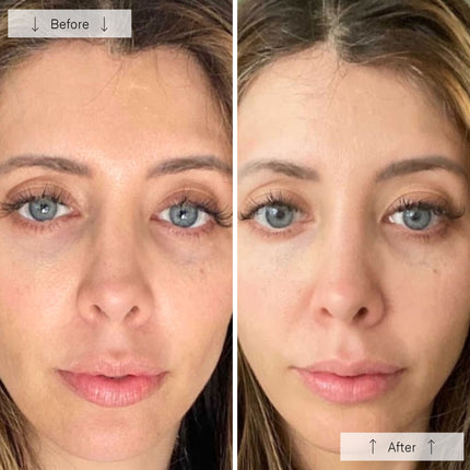 StrideNurture Contour Face