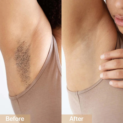 StrideNurture IPL - Fast & Effective Hair Removal