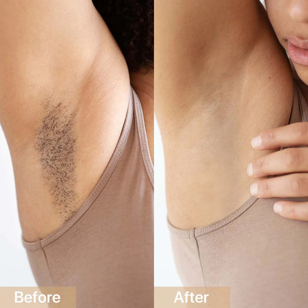 <strong>This really works, definitely recommend!</strong>